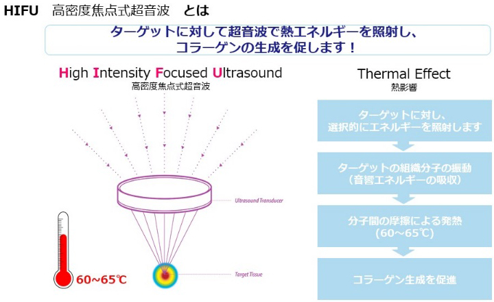 ウルトラセルキュープラス