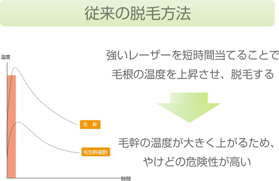 従来の脱毛方法。強いレーザーを短時間当てることで毛根の温度を上昇させ、脱毛する。毛幹の温度が大きく上がるため、やけどの危険性が高い。