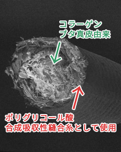 断面の走査型電子顕微鏡写真